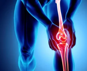 آرتروز زانو چیست؟ علائم، علل و تفاوت آن با نرم شدن غضروف