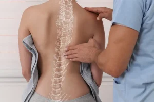علائم بالینی و نشانههای قابل مشاهده اسکولیوز