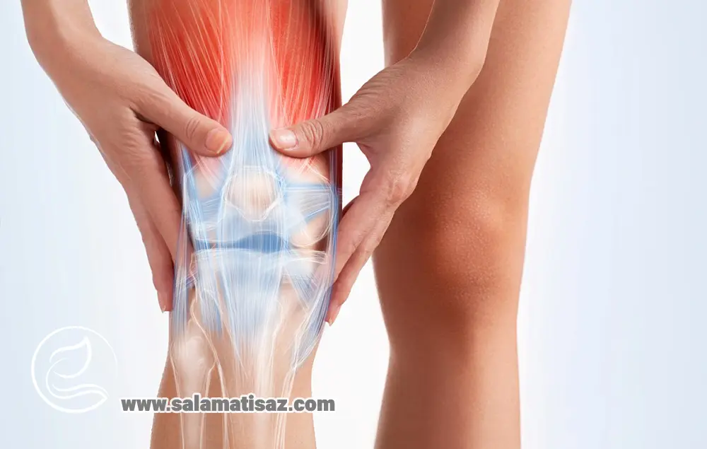 آرتروز زانو چیست؟ علائم، علل و تفاوت آن با نرم شدن غضروف