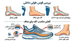 کفش مناسب کف پای صاف و بررسی قوس طولی داخلی