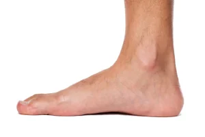 کف پای صاف دقیقاً یعنی چه؟