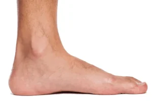 علائم کف پای صاف چیست