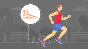 آناتومی چرخش بیش از حد پا به داخل Overpronation در دوندگان
