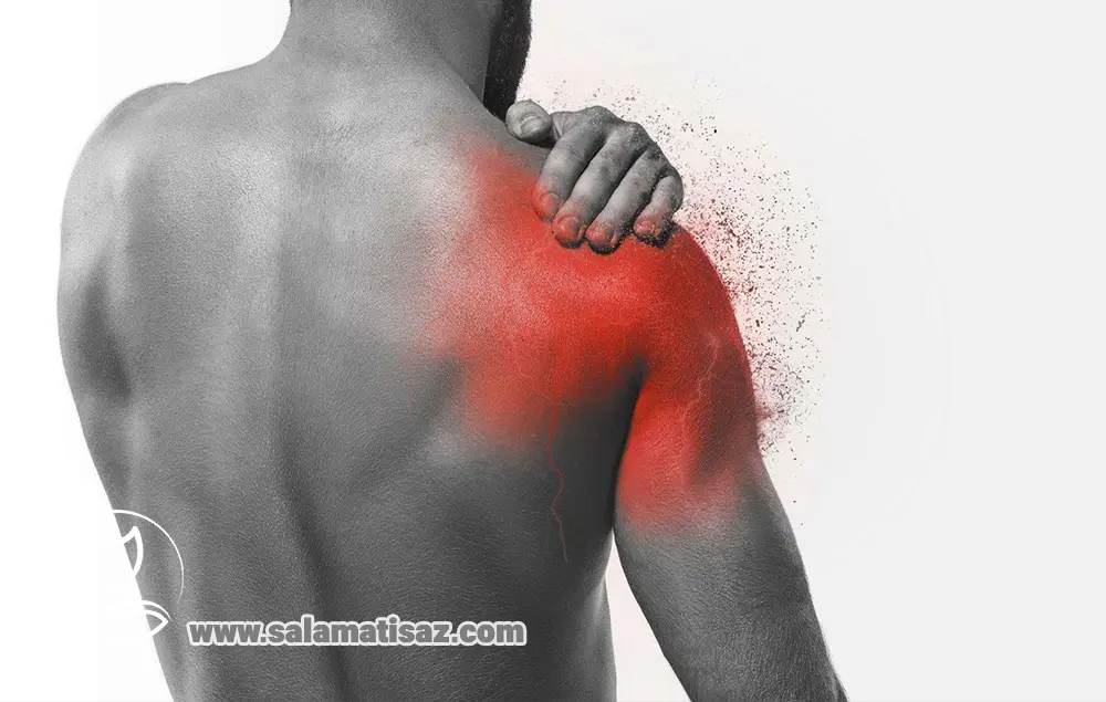 شانه یخ‌زده (Frozen Shoulder) علائم، مراحل و بهترین درمان‌ها