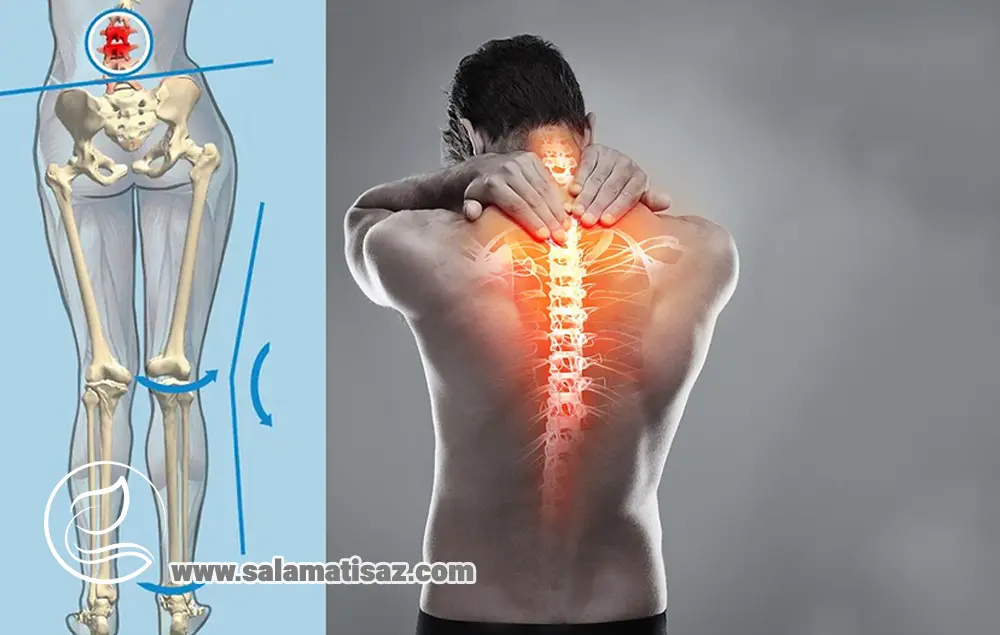 کف پای صاف و کمردرد؛ آیا صافی کف پا باعث کمردرد می‌شود؟
