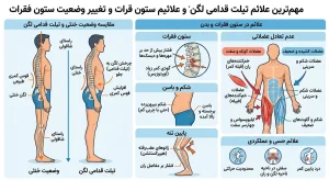 مهمترین علائم تیلت قدامی لگن و تغییر وضعیت ستون فقرات