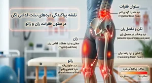 نقشه پراکندگی دردهای تیلت قدامی لگن در ستون فقرات، ران و زانو