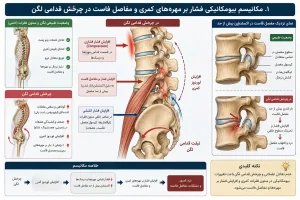 مکانیسم بیومکانیکی فشار بر مهرههای کمری و مفاصل فاست در چرخش قدامی لگن