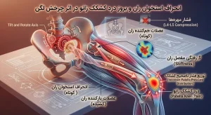 انحراف استخوان ران و بروز درد کشکک زانو در اثر چرخش لگن