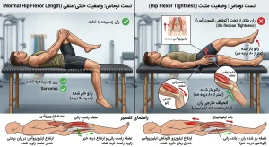 تست توماس برای تشخیص کوتاهی عضلات خم‌کننده ران در ورزشکار