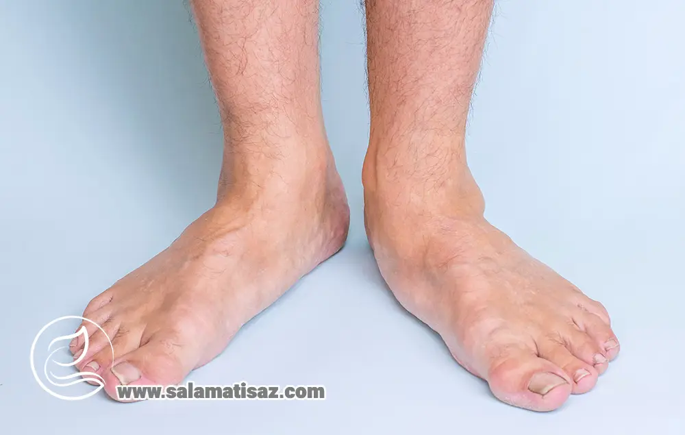 تشخیص کف پای صاف نزد پزشک؛ روش‌های معاینه و چه زمانی به متخصص مراجعه کنیم